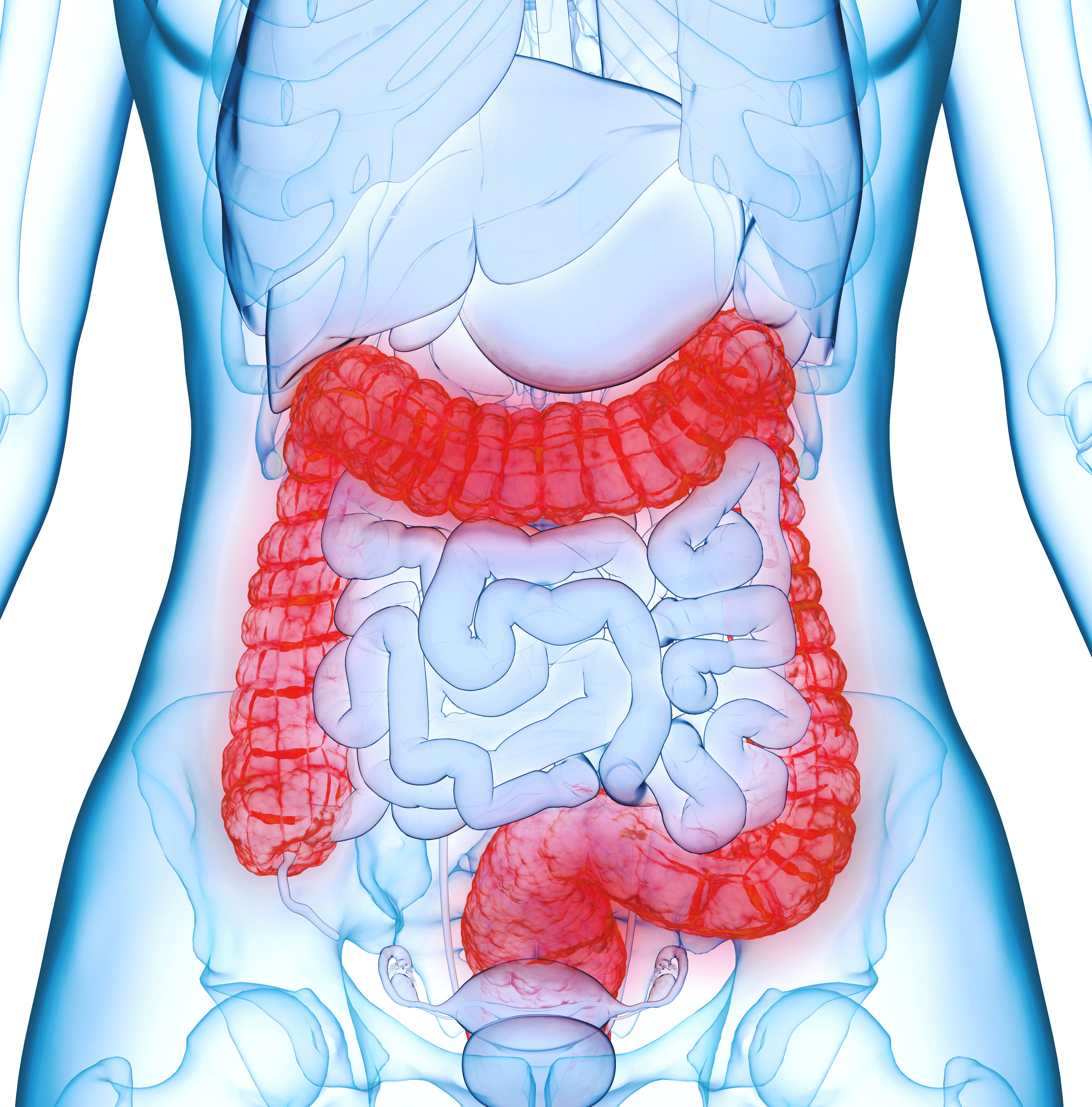 CROHN’S DISEASE